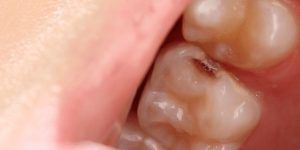hábitos dentales