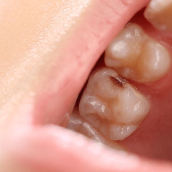 hábitos dentales