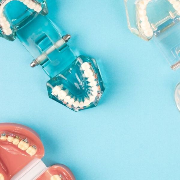 Brackets Vs Ortodoncia Invisible