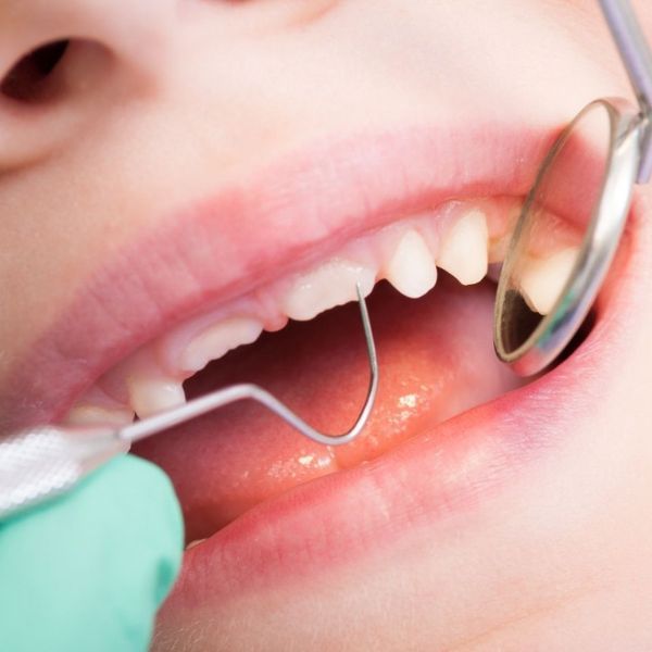 odontopediatría