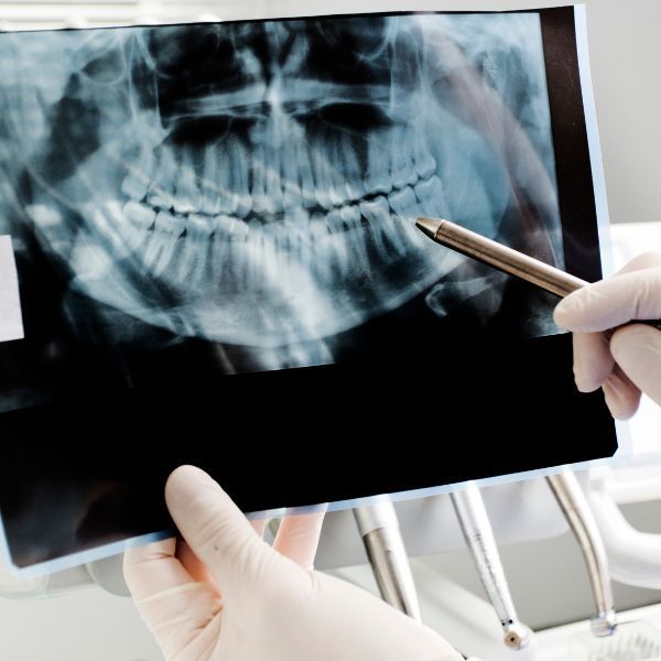Radiografía dental