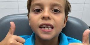 dientes de leche