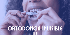 Ortodoncia Invisible vs brackets