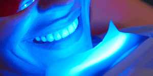 blanqueamiento dental