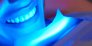 blanqueamiento dental