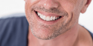 implantes dentales
