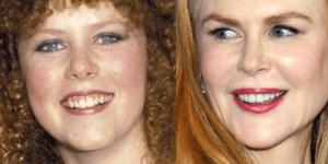 Sonrisa de los Famosos