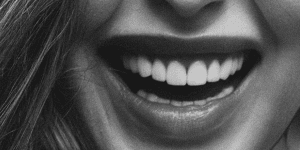 rejuvenecimiento dental