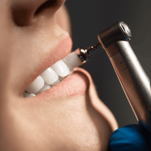 limpieza dental