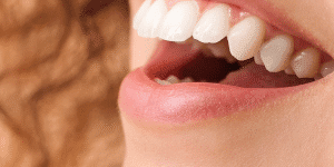 Cómo cuidar tus dientes tras los excesos del verano
