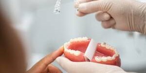 Colocar los dientes en su sitio no basta