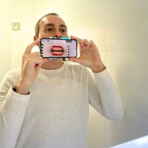 paciente escaneándose con dental monitoring