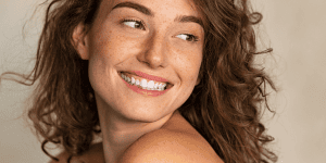 blanqueamiento dental en verano Totana y Puerto de Mazarrón
