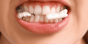 Niño masticando de forma alterna por ambos lados bajo la supervisión de un dentista en Clínica Dental Carmona en Totana y Puerto de Mazarrón